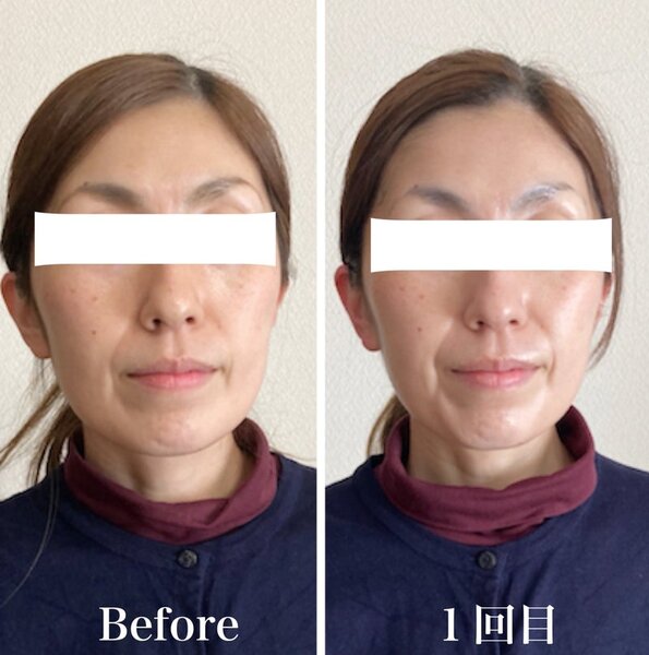 お腹痩せ・脚痩せ×エイジングケアエステサロン ユーフルール　 | 松阪のエステサロン