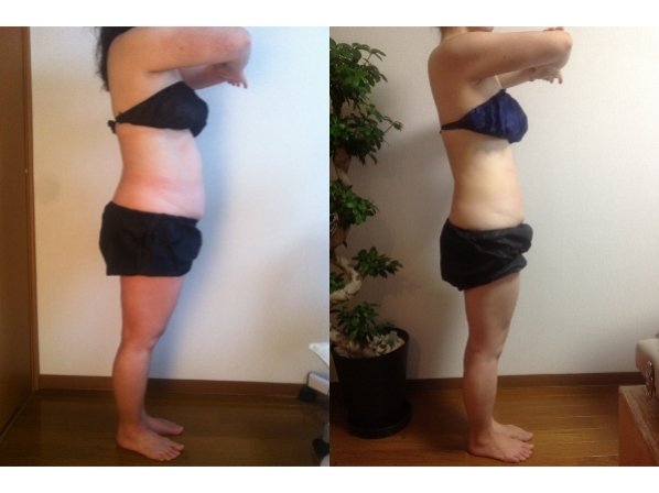 痩身小顔サロン Mix up!! 練馬店 | 練馬のエステサロン