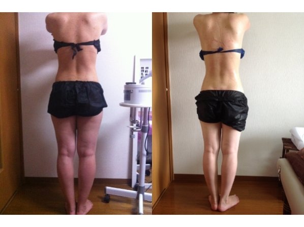 痩身小顔サロン Mix up!! 練馬店 | 練馬のエステサロン