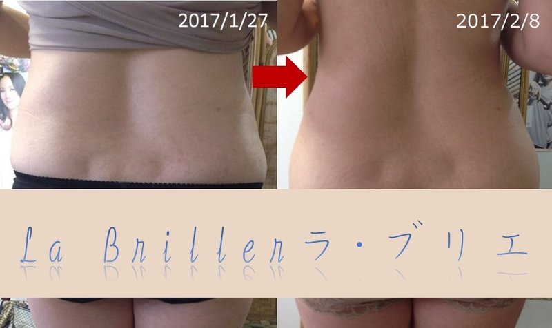 プライベートフェイシャルサロン　Ｌａ　Ｂｒｉｌｌｅｒ | 宇治のエステサロン