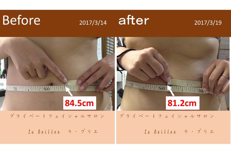 プライベートフェイシャルサロン　Ｌａ　Ｂｒｉｌｌｅｒ | 宇治のエステサロン