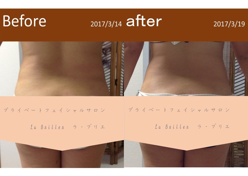 プライベートフェイシャルサロン　Ｌａ　Ｂｒｉｌｌｅｒ | 宇治のエステサロン