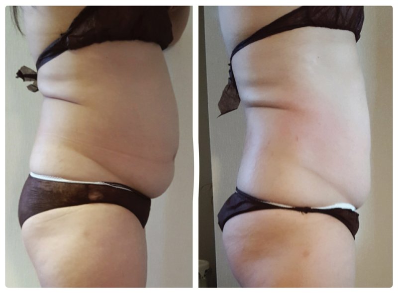 Le Coeur. Esute | 宇治のエステサロン