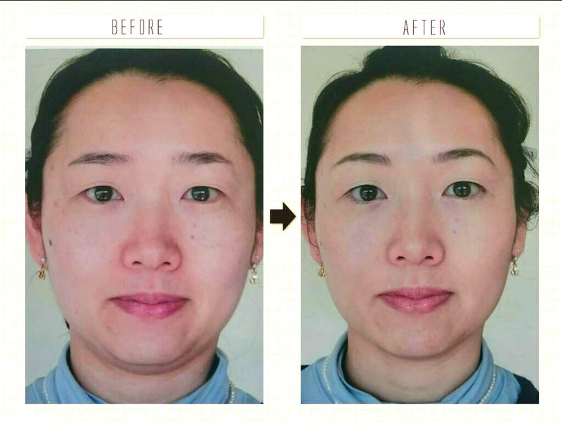 プライベートサロンgraceful | 高知のエステサロン プライベートサロンgraceful | 高知のエステサロン