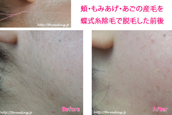 BRILLIANCE | 名駅のエステサロン