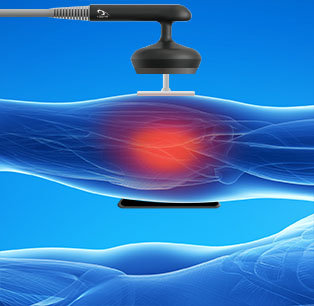 【ラジオ波温熱整体】中目黒クラール整骨院 | 中目黒のリラクゼーション