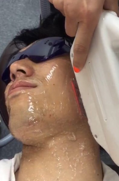 Men's SALON RON | 新宿のエステサロン