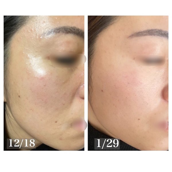 Private esthe salon essence | 東近江のエステサロン Private esthe salon essence | 東近江のエステサロン