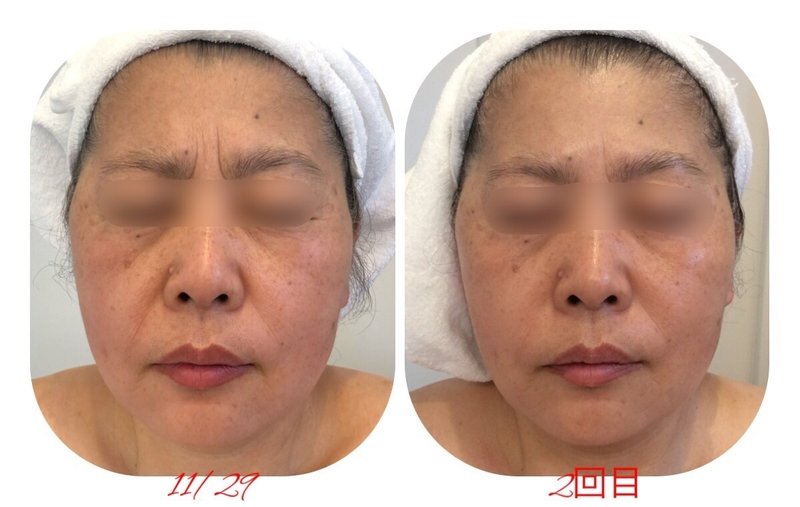 Private esthe salon essence | 東近江のエステサロン Private esthe salon essence | 東近江のエステサロン