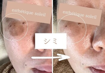 esthetique soleil | 三島のエステサロン