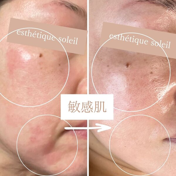 esthetique soleil | 三島のエステサロン