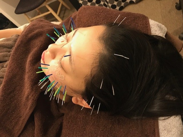 アキュリード(美容鍼灸エステサロン) | 元町のエステサロン