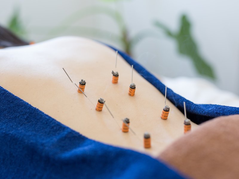 すみれ鍼灸マッサージ院 | 沼津のエステサロン