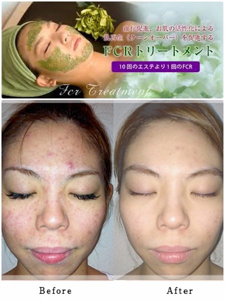 エステティックサロンフリーパス | 沖縄のエステサロン