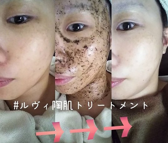 脱毛ルームVenus | 岡山のエステサロン 脱毛ルームVenus | 岡山のエステサロン