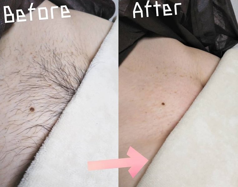 脱毛ルームVenus | 岡山のエステサロン 脱毛ルームVenus | 岡山のエステサロン