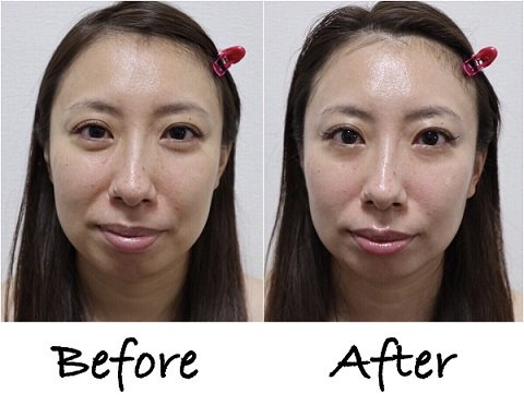 ISLAND BEAUTY | 川崎のエステサロン ISLAND BEAUTY | 川崎のエステサロン