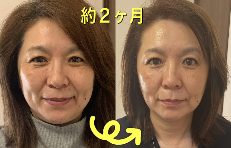 home salon YUNO | 戸塚のエステサロン