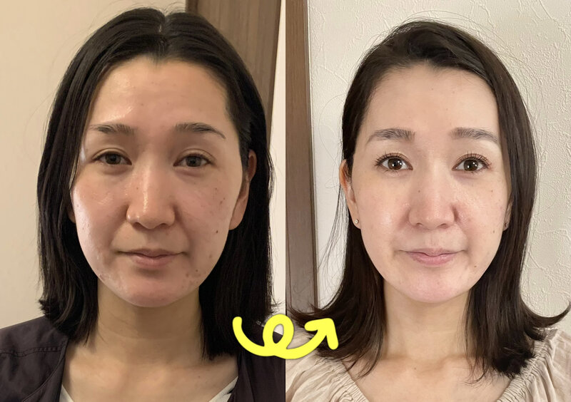 home salon YUNO | 戸塚のエステサロン