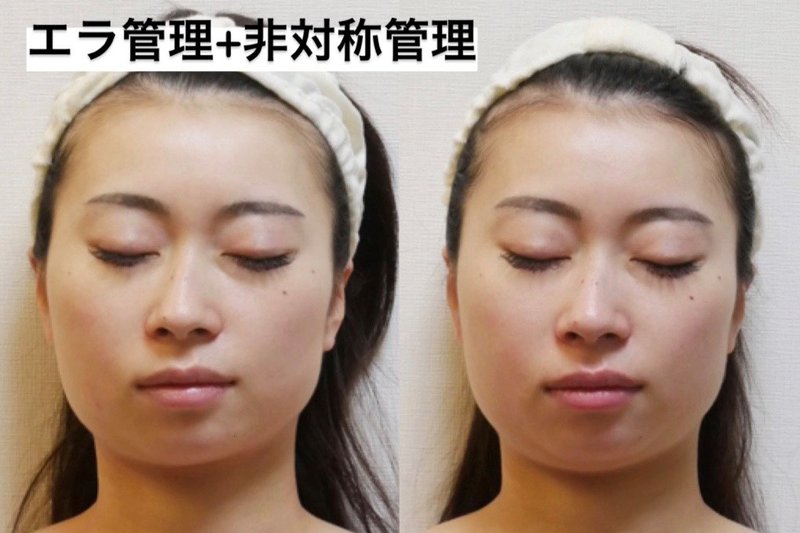 韓国式小顔術 Les Fleurs | 博多のエステサロン 韓国式小顔術 Les Fleurs | 博多のエステサロン