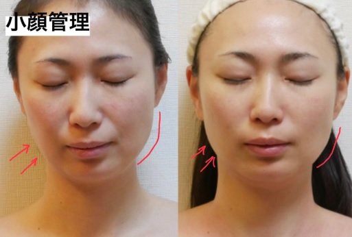韓国式小顔術 Les Fleurs | 博多のエステサロン 韓国式小顔術 Les Fleurs | 博多のエステサロン
