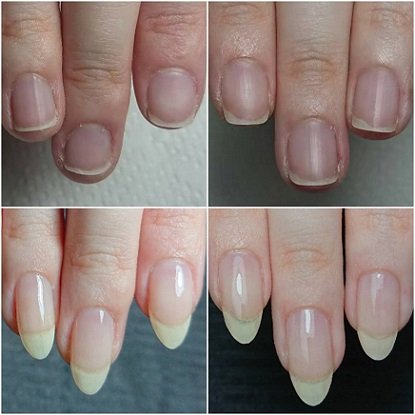 美爪育成・巻き爪サロンJeliss | 八千代のネイルサロン