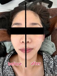 フェイシャルプライベートサロン-haristeria-