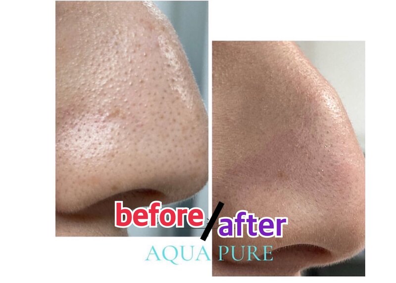 フェイシャルプライベートサロン-haristeria- | 天王寺/阿倍野のリラクゼーション