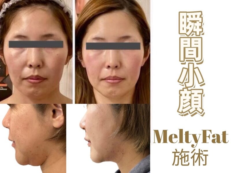 Hatten Beauty Park 810 神戸店 | 元町のエステサロン