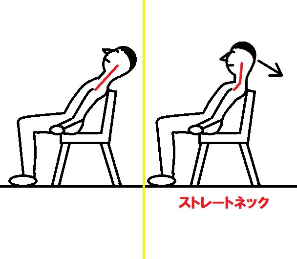 [アイキャッチ]首コリ体操