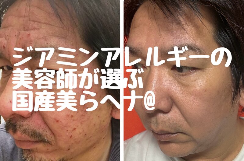 [アイキャッチ]ジアミンアレルギーの美容師が使用する国産美らヘナ@は愛媛西条美容室〜想〜