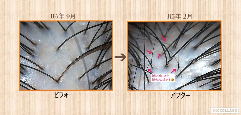 [アイキャッチ]～MOUMITU～ スカルプトリートメント