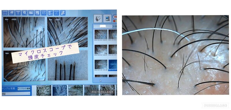 [アイキャッチ]頭皮・毛髪のお悩みもお任せください！◝(⁰▿⁰)◜