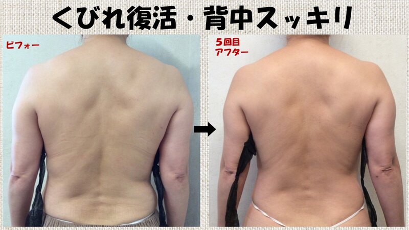 [アイキャッチ]🔥段差ボディ、今年こそ卒業🔥