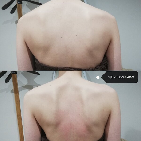 [アイキャッチ]ブライダルエステ専門店RiとBiのたまごのエステで一生に一度の素敵な日に