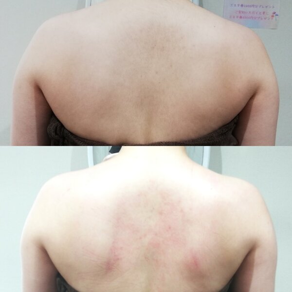 [アイキャッチ]ガチガチ背中が１回でスッキリ！RiとBiのたまごの上半身マッサージの効果とは？