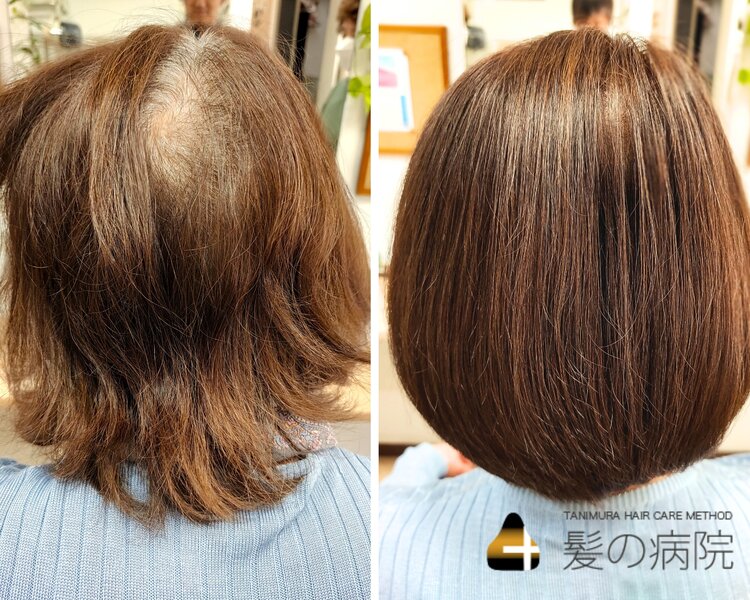 [アイキャッチ]カットなし【頭皮気になる方】エイジレスカラー+頭皮デトックスケア￥12100→10450