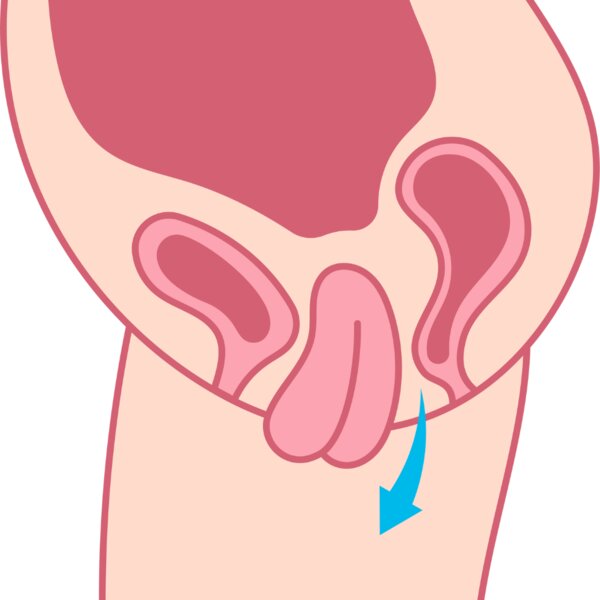 [アイキャッチ]【骨盤底筋トレーニング】今話題の膣トレ