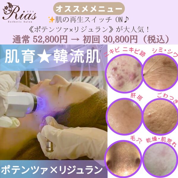 [アイキャッチ]✨肌の再生スイッチ ON♪ Riasの《ポテンツァ×リジュラン》が大人気！