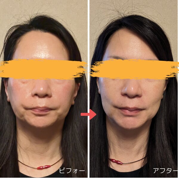 [アイキャッチ]フェイシャルコースのビフォー・アフター