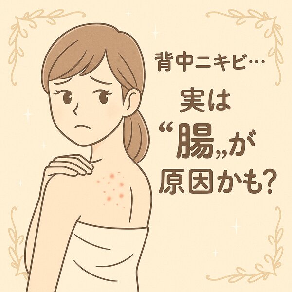 [アイキャッチ]✧.˚「背中ニキビ…実は“腸”が原因かも？」˚✧ ⟡.·. 見えないところだからこそ、やさしく整えるケアの話♡