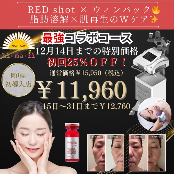 [アイキャッチ]🔥《WINBACK BACK4》×《RED shot》最強コラボキャンペーン実施中🔥