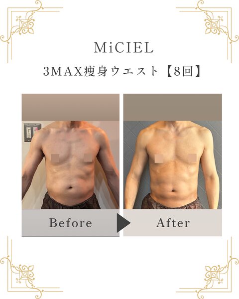 [アイキャッチ]3MAX痩身〜ウエスト〜40代男性ビフォーアフター