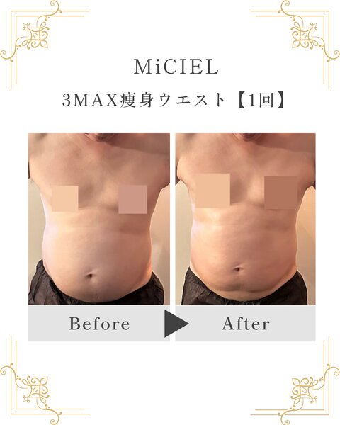 [アイキャッチ]3MAX痩身〜ウエスト〜40代男性ビフォーアフター