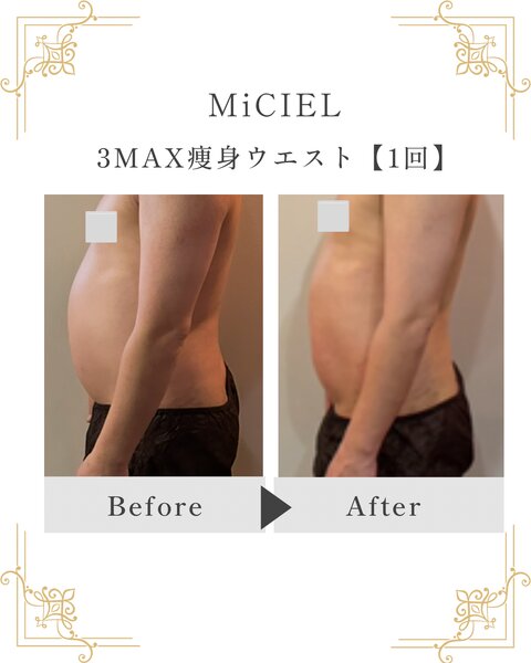 [アイキャッチ]3MAX痩身〜ウエスト〜40代男
